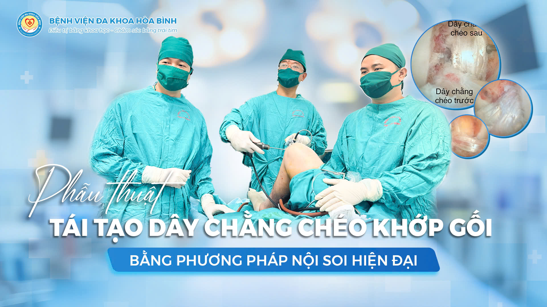  Phẫu thuật tái tạo dây chằng chéo khớp gối – Giải pháp hiệu quả giúp phục hồi vận động tại Bệnh viện Đa khoa Hòa Bình