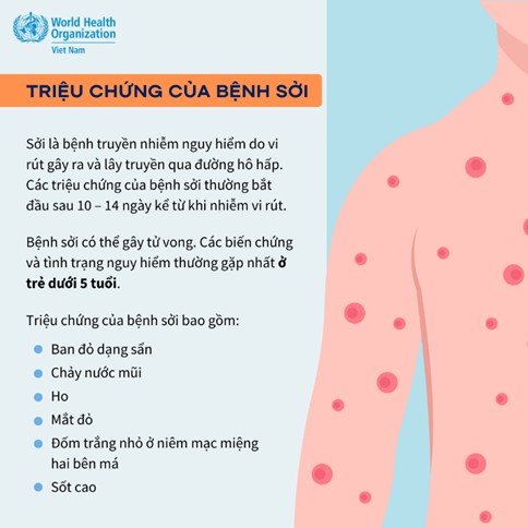  Bệnh Sởi và những điều cần lưu ý